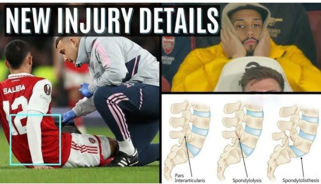 Arsenal injury update: William Saliba, Riccardo Calafiori and Ethan Nwaneri latest news and return dates